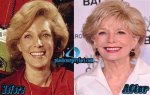60 Minutes: Did Leslie Stahl Undergo Facelift? American Journalist's New Look Explored