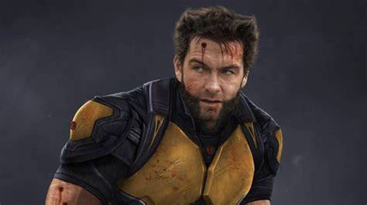 Antony Starr: the Wolverine We Didn't Know We Needed