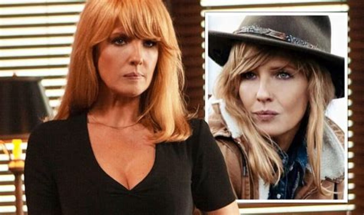 Beth Dutton Lip Injections: Surgery Before and After Photos
