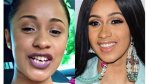 Cardi B Teeth Fixed Before and After: a Comprehensive Look
