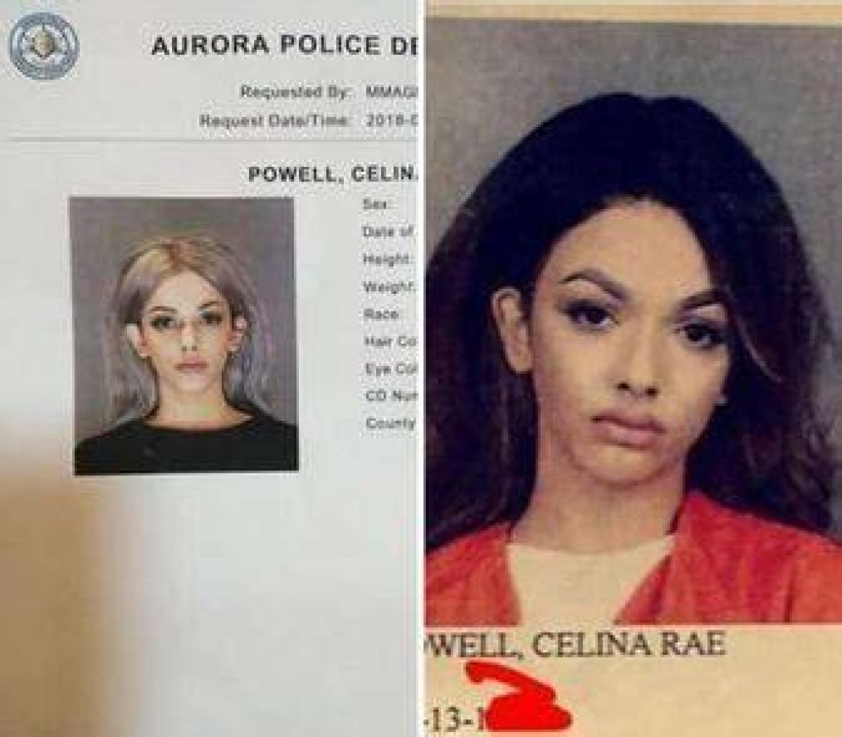 Celina Powell Before and After Plastic Surgery