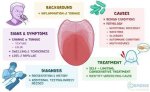 Definitive Guide to Drummond Diagnosis: Symptoms, Causes, and Treatment