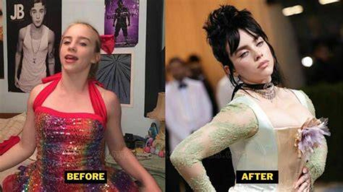 Did Billie Eilish Have Breast Reduction? Exploring the Truth Behind the Rumors