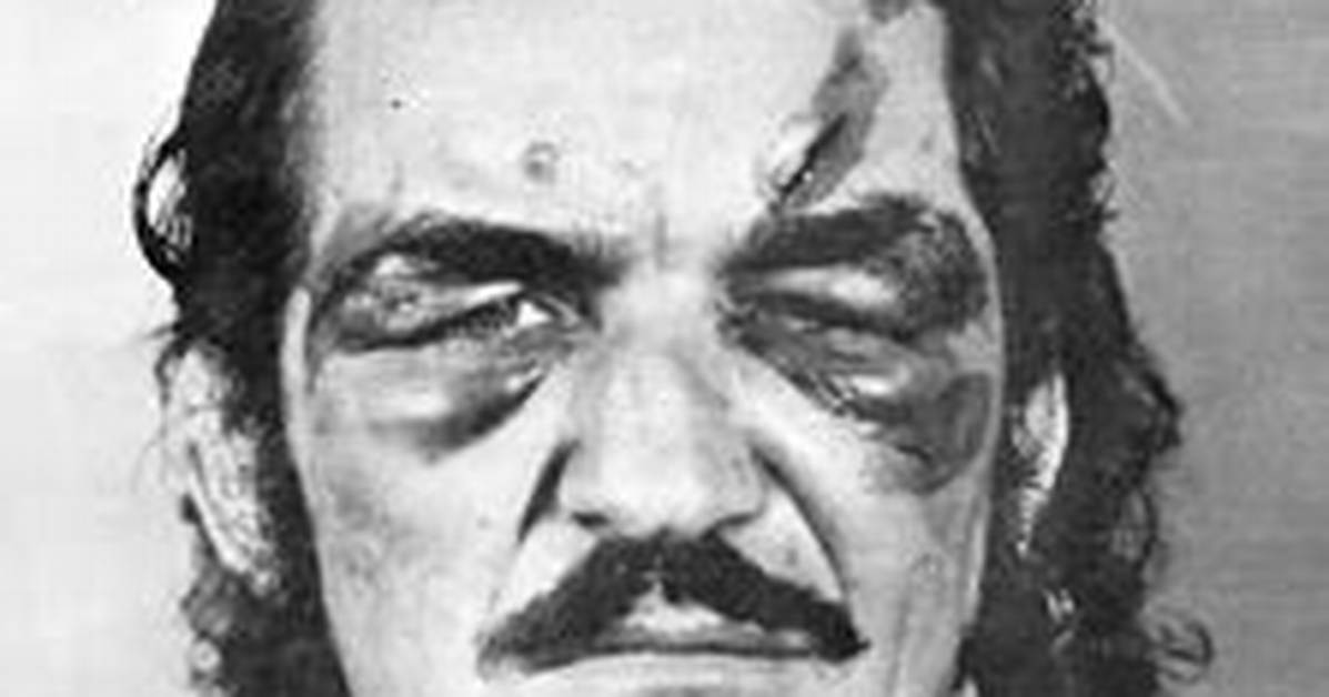 Did Someone Poke Mario Galento Eye? Wrestler Net Worth 2022