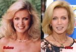Donna Mills' Plastic Surgery Journey Revealed