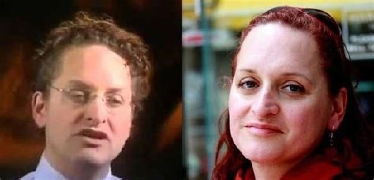Dr. Lynette Nusbacher Before Surgery: a Journey of Transformation