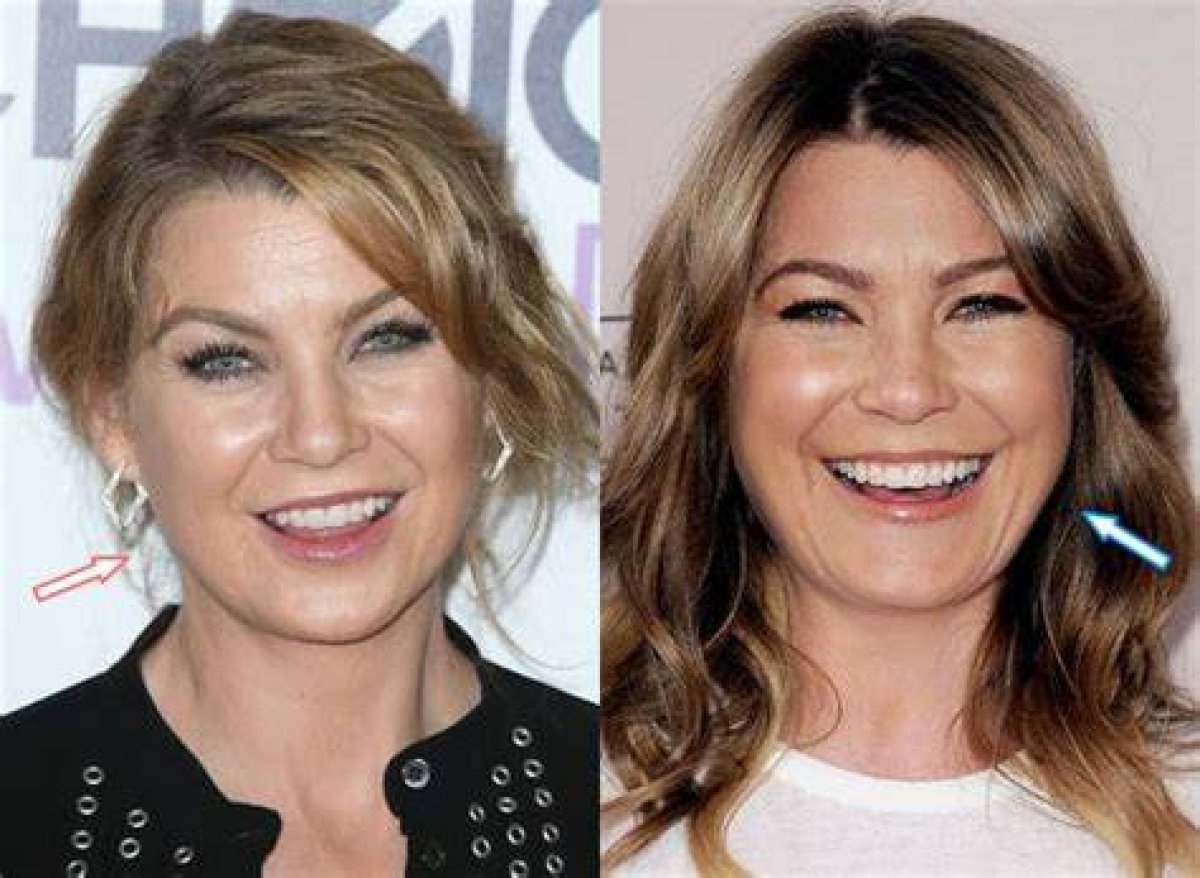 Ellen Pompeo's Transformation: Plastic Surgery Unveiled!