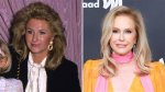 Has Rhobh Kathy Hilton Done Plastic Surgery? Fans Suspect Botox and Nose Job ·