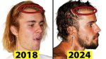 Is Justin Bieber Aging Too Fast? the Surprising Transformation