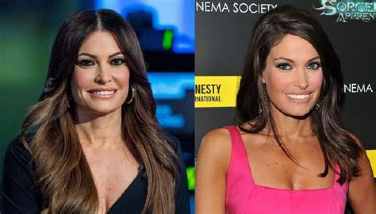 Kimberly Guilfoyle Before and After: a Comprehensive Look at Her Transformation