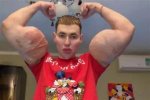 Kirill Tereshin Biography, Age, Fiancee, Net Worth, Surgery, Fight and Arms