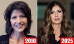 Kristi Noem: the Journey of Transformation Through Plastic Surgery