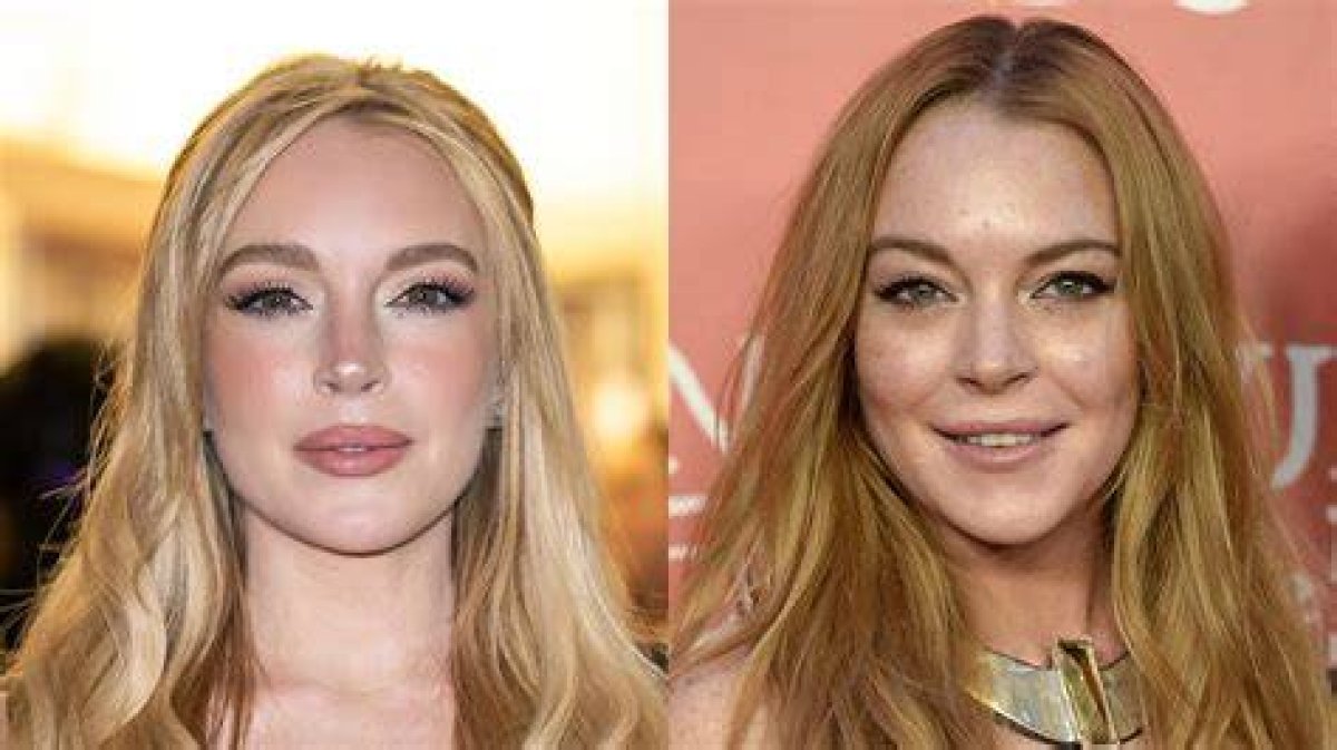 Lindsay Lohan's Plastic Surgery Journey: Unlocking the Truths