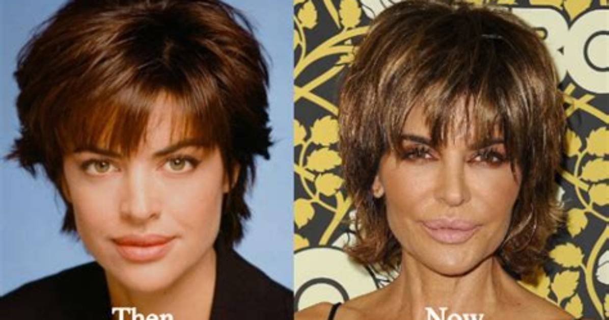 Lisa Rinna Before Surgery: a Deep Dive into Her Transformation