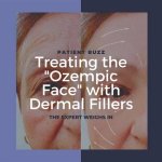 Lupus and Taking Ozempic: Understanding the Connection