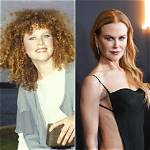 Nicole Kidman's Plastic Surgery Journey Explored