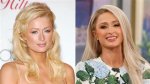 Paris Hilton's Surprising Plastic Surgery Journey: Before and After Photos
