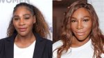 Serena Williams Plastic Surgery: Unveiling the Truth Behind the Rumors