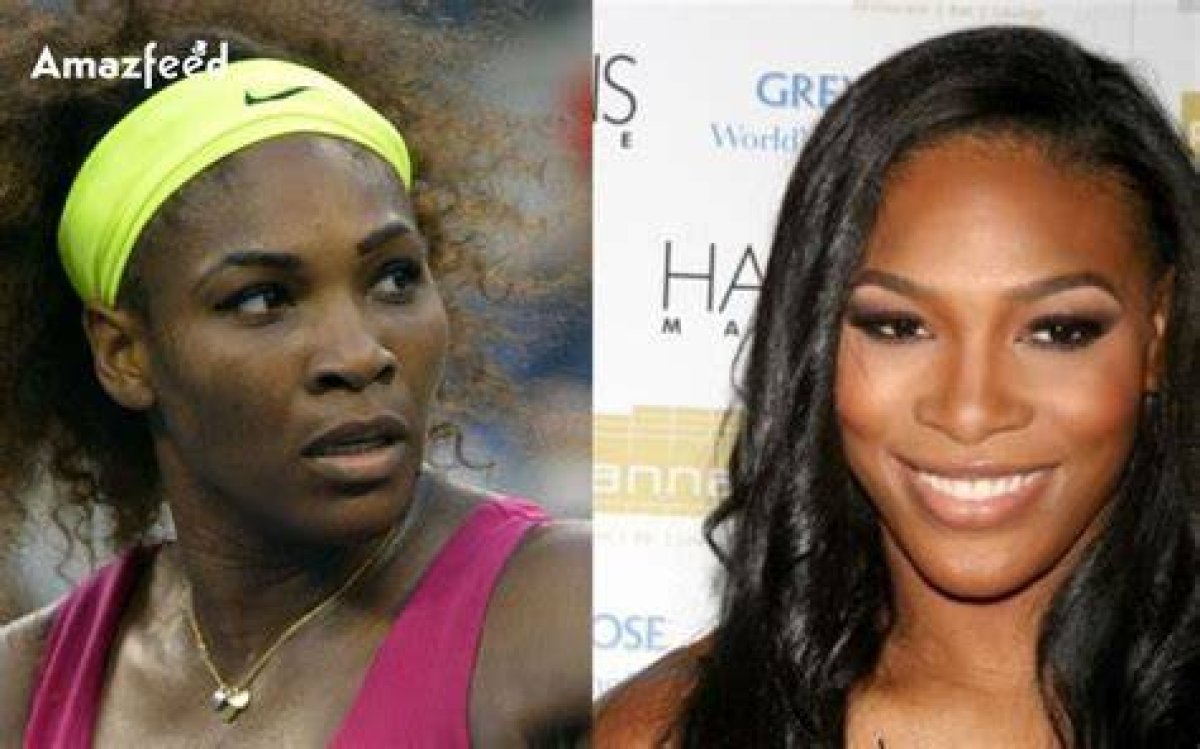 Serena Williams Surgery: a Comprehensive Insight into Her Journey and Recovery