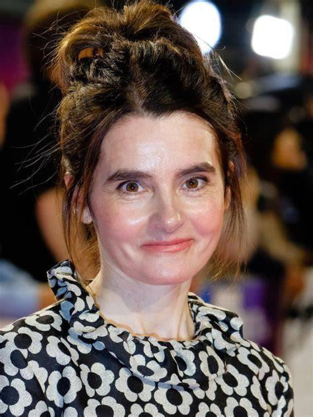 Shirley Henderson's Triumph over Physical Challenges