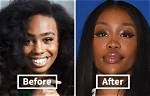 Sza Nose Job: the Truth Behind the Rumors and Transformations