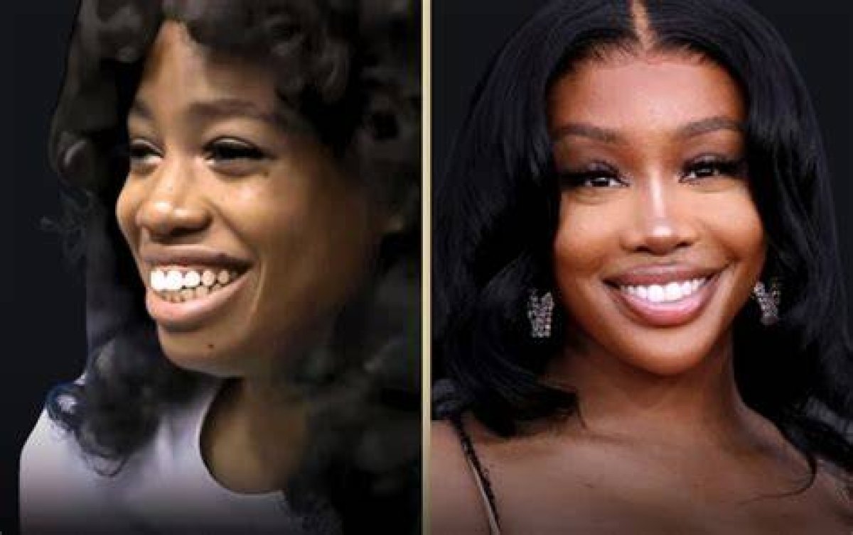 Sza's Plastic Surgery Journey and Its Impact