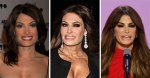 The Truth About Kimberly Guilfoyle's Lip Surgery