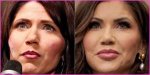 Transformation Chronicles: Kristi Noem Before and After Cosmetic Surgery