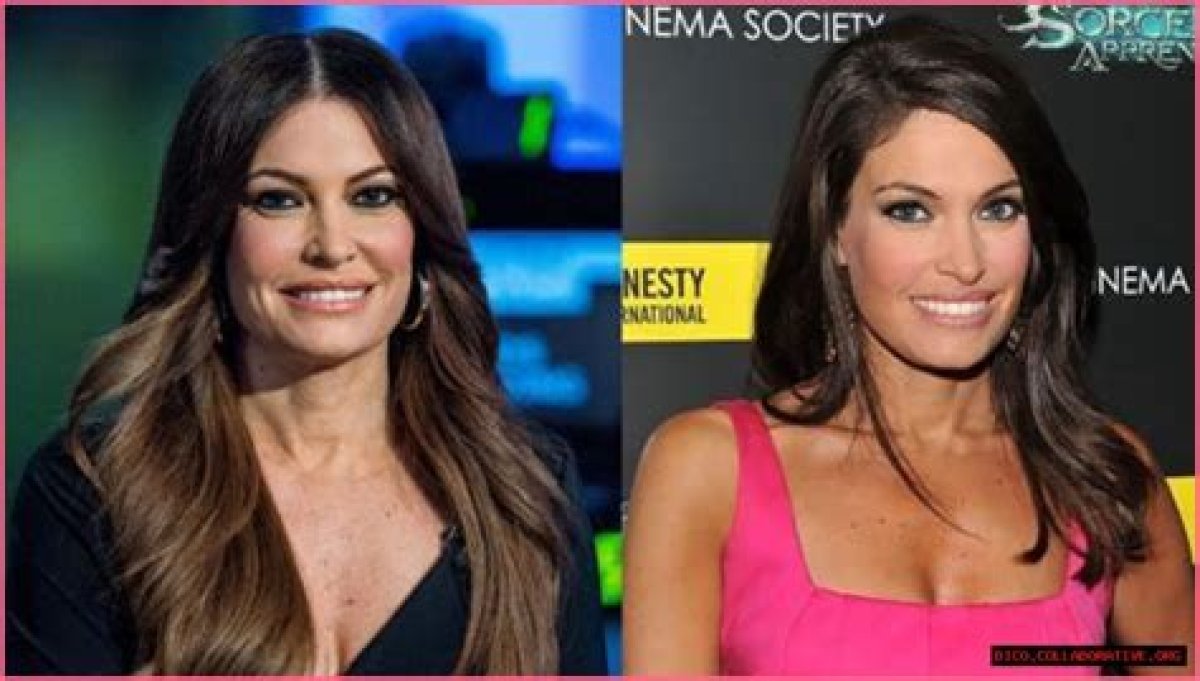 Transformative Journey: Kimberly Guilfoyle Before and After Surgery
