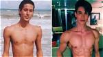 Transforming Beauty: the Journey of Justin Jedlica and His Plastic Surgery
