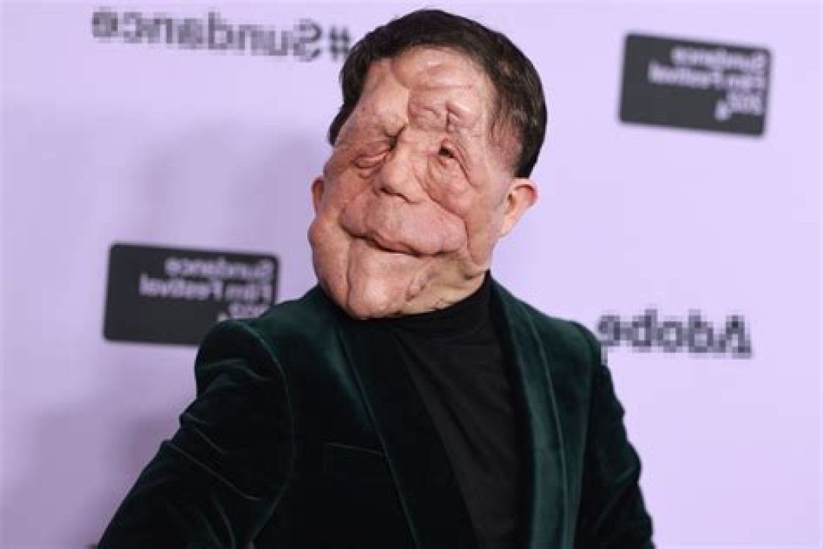 Understanding Adam Pearson's Girlfriend: a Deep Dive into His Personal Life