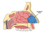Understanding Kiesselbach Plexus: the Crucial Role in Nasal Health
