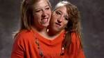 Understanding the Lives of Abby and Brittany Hensel: the Separation Question
