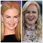 Unveiling the Truth Behind Nicole Kidman’s Plastic Surgeries