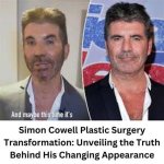 Unveiling the Truth Behind Simon Cowell's Botox Journey