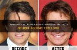 Unveiling the Truth Behind Tom Cruise's Bad Teeth
