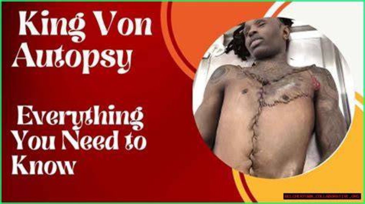 Unveiling the Truth: the King Von Autopsy Pic and Its Impact